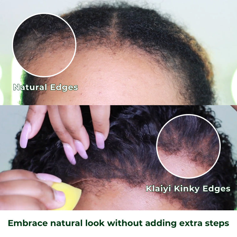 Klaiyi 4c Kinky Edge Kinky Curly Skin Melt 7x5 Bye Bye Knots Wig Virgin Human Hair Natural Hairline